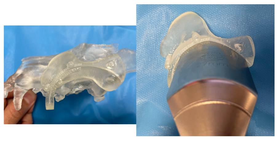 Caudal maxillectomy guide with TPLO blade
