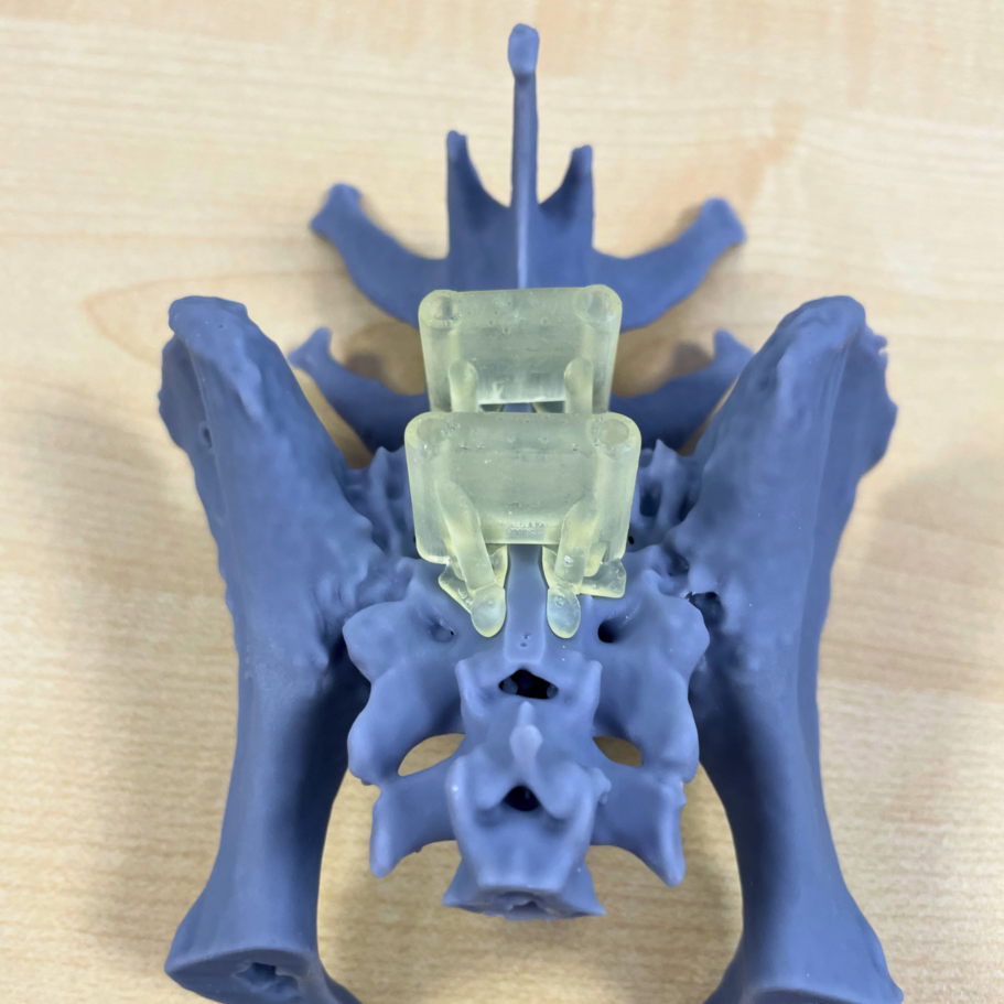 Lumbosacral guides