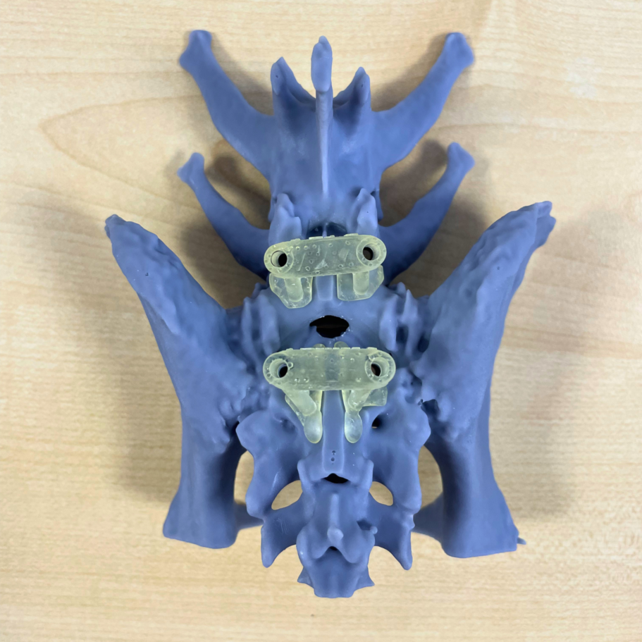 Lumbosacral guides