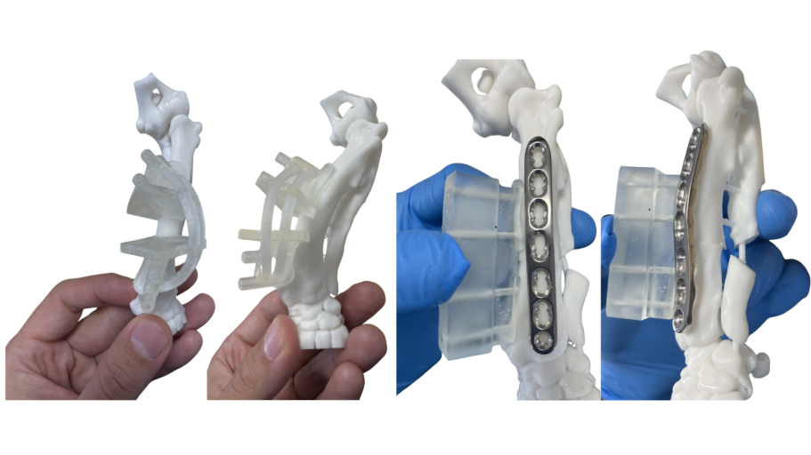 Antebrachial growth deformity correction
