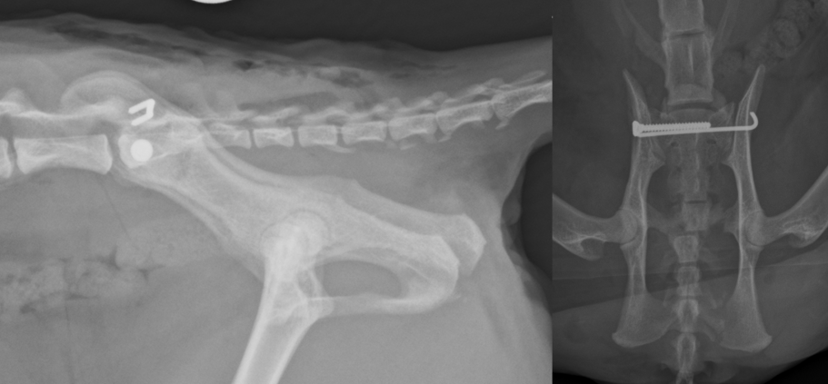 Post-operative radiographs