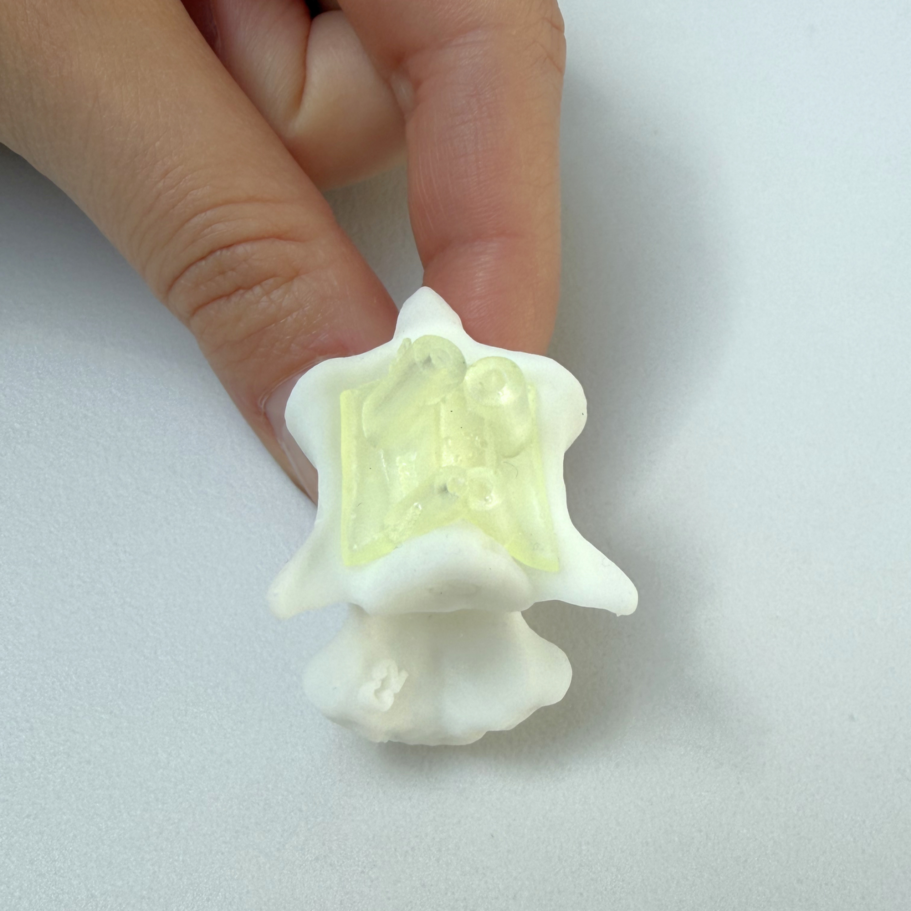 C2 ventral guide